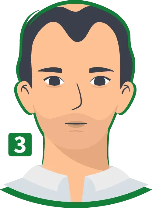 Calvo-P3-min.webp