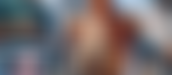 Revolutionize Your Smile: Advantages of Digital X-rays