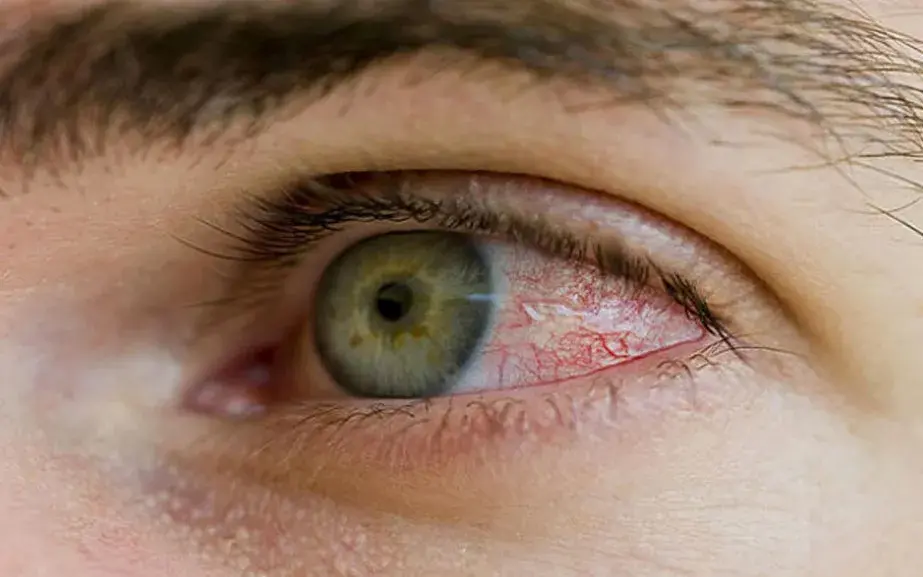 Diyabetik Retinopati Tedavisi: Op. Dr. Karadağ’dan Kritik Uyarılar