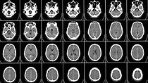 brain-imaging-breakthrough-may-offer-mri-alternative-349829-960x540.jpg