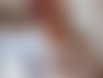 【子宮頸癌施術後】