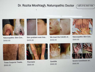 We treat any skin conditions naturally