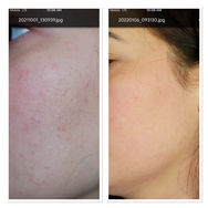 We Treat ANY Skin Conditions Naturally
