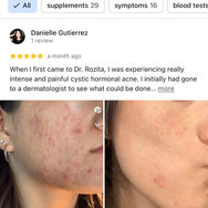 Happy Treated acne patient