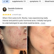 Happy Treated Acne Patient