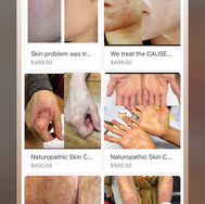 We treat any skin conditions naturally