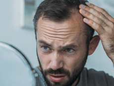 Hair loss