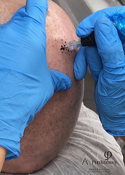 Scalp Micropigmentation (2).jpg