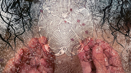 2.Cerebral Touch-Magnetic Resonance II.jpg