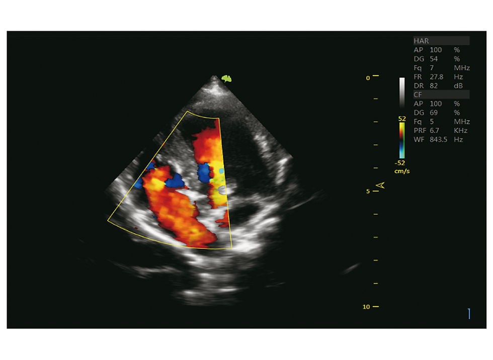 Miniaturbild: Ultraschallgerät VINNO 5 VET US-Bild 3
