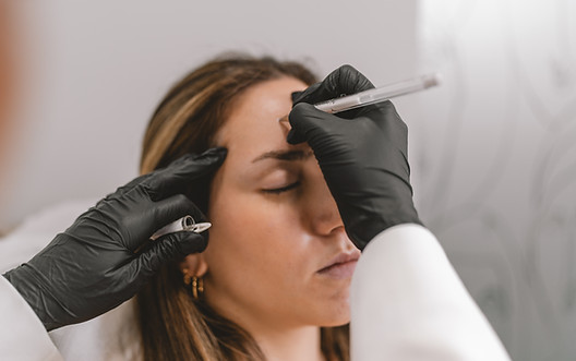 drawing-the-face-of-a-client-to-inject-with-botox-2025-03-09-11-35-07-utc.jpg