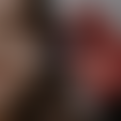 Achieve a Younger Look with FDA-Approved Neurotoxins