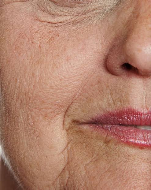 aging skin.jpg