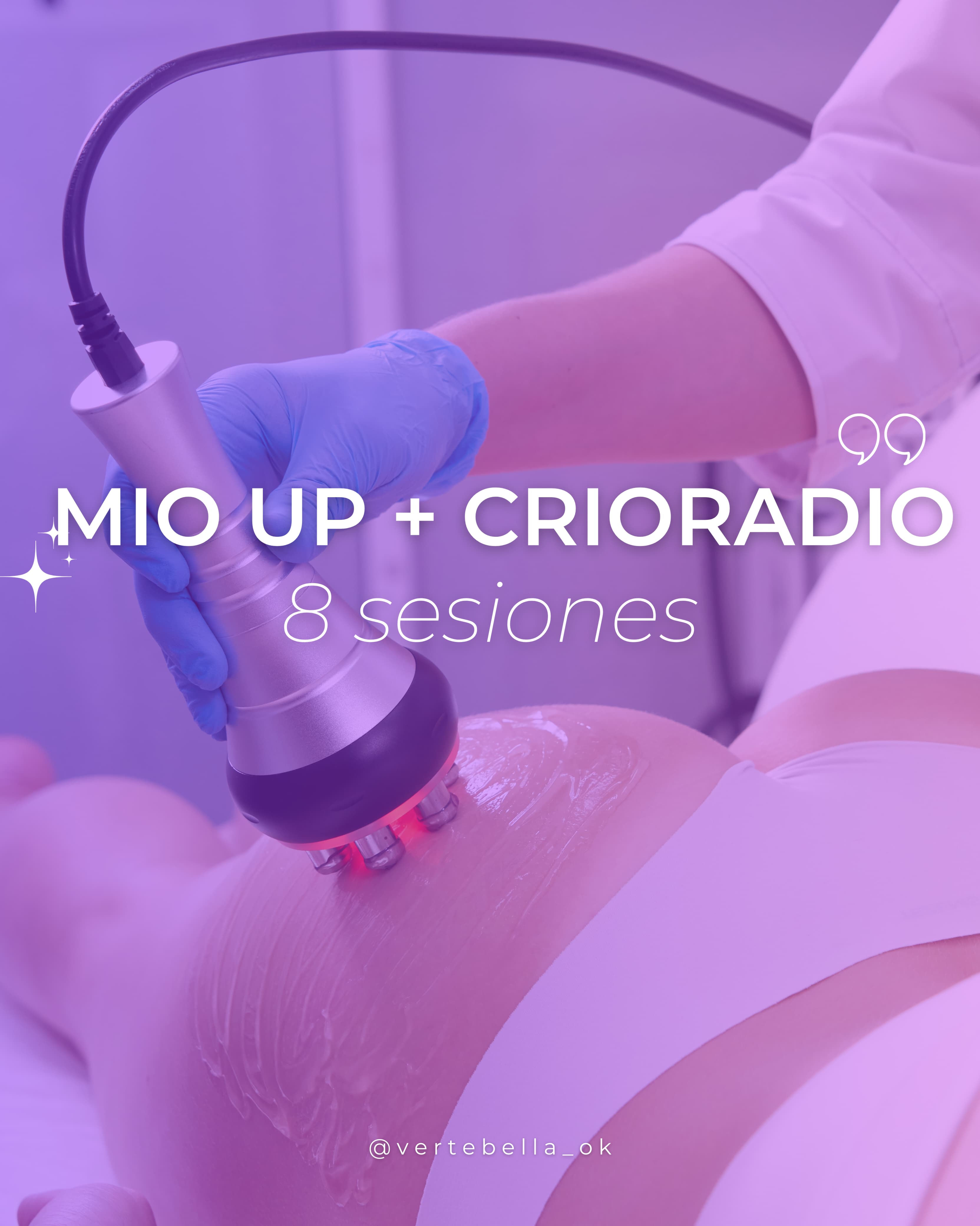 8 sesiones Mio Up + Crioradiofrecuencia