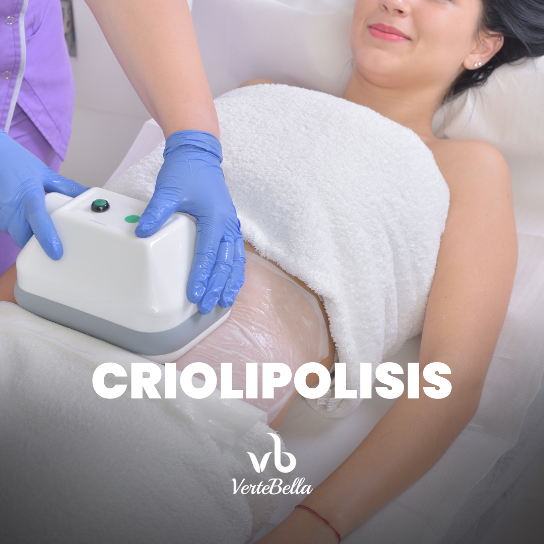 Criolipolisis