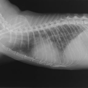 敗血症による重度肺炎と心タンポナーデ