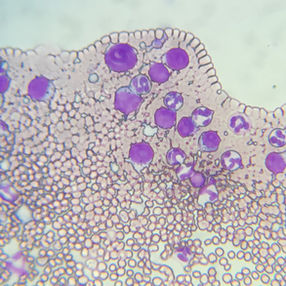 猫の胃のリンパ腫