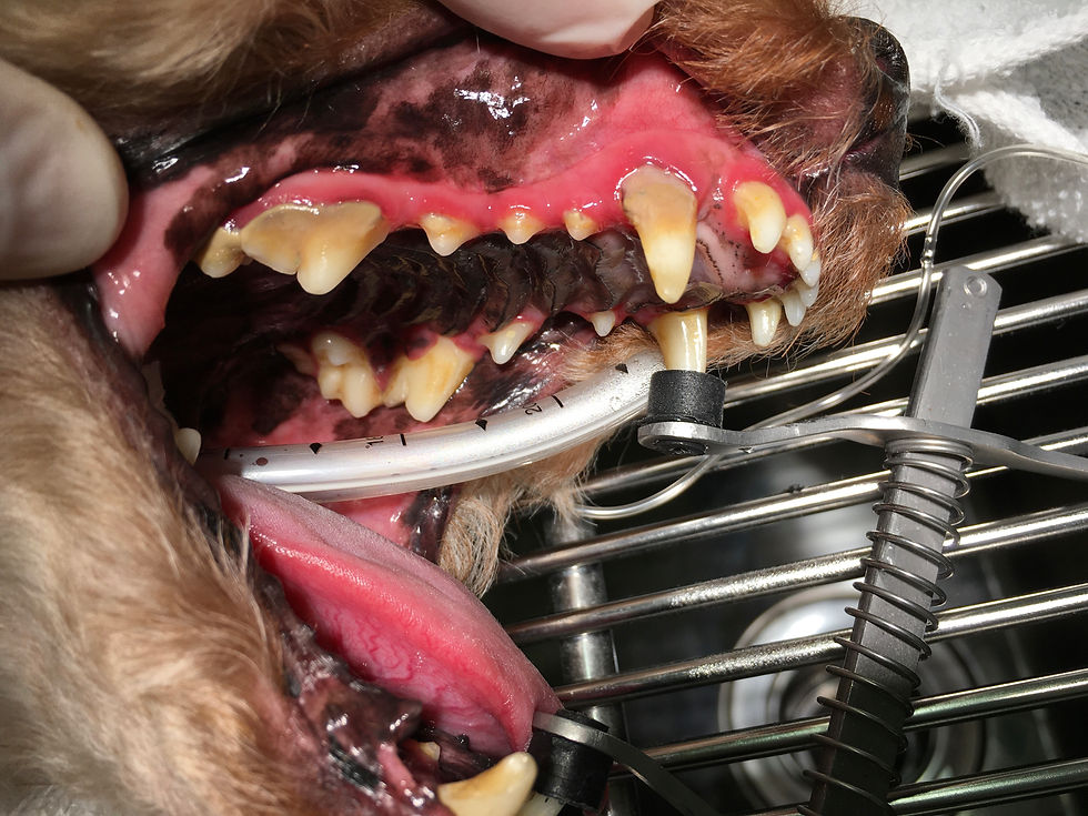 歯石除去キャンペーン