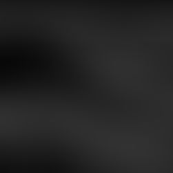 犬の膀胱腫瘍と化学療法