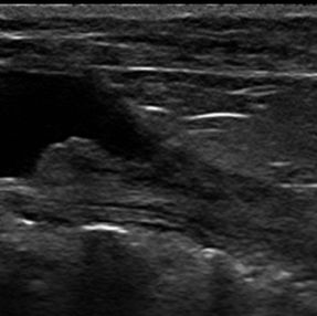 犬の膀胱腫瘍と化学療法