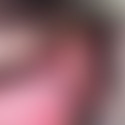 犬の扁桃腺の悪性腫瘍