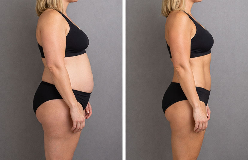 Thumbnail: 20 Week Body Transformation 