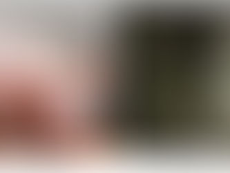 돼지 심장 이식받은 원숭이 생존 국내 최장 기록