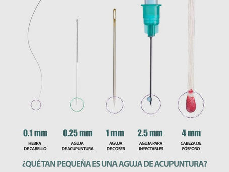 Agujas de acupuntura
