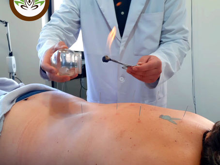 Hablemos sobre las Ventosas Fijas