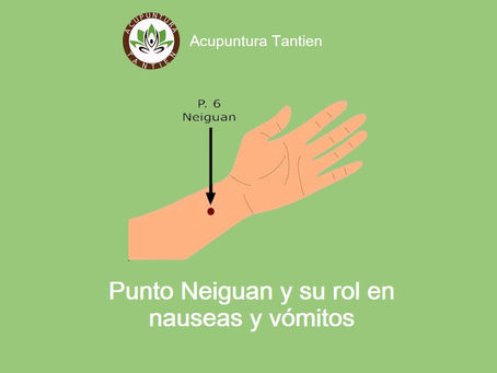 Punto Neiguan y su rol en nauseas y vómitos