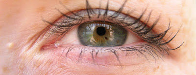 ¿Qué son esas pequeñas manchas oscuras en el iris de mis ojos?