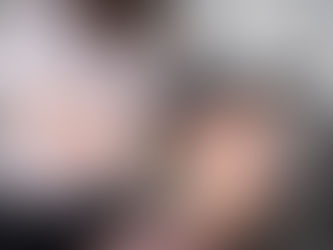 How Many Botox Units Do I Need? | Botox Nanaimo with Nurse Moreen