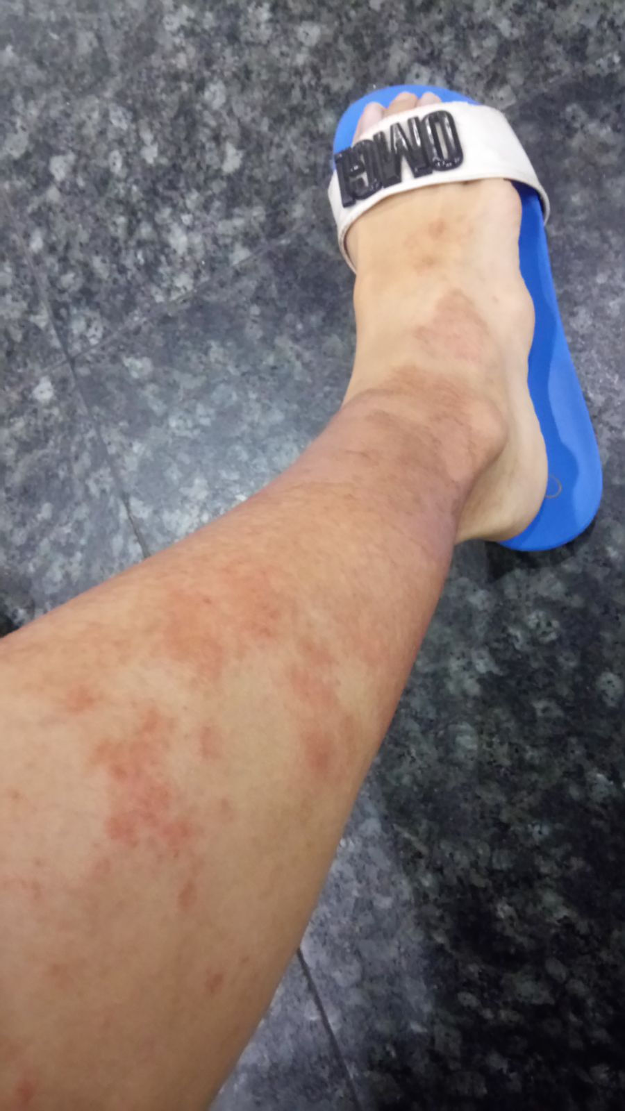 Right Leg - September 2017