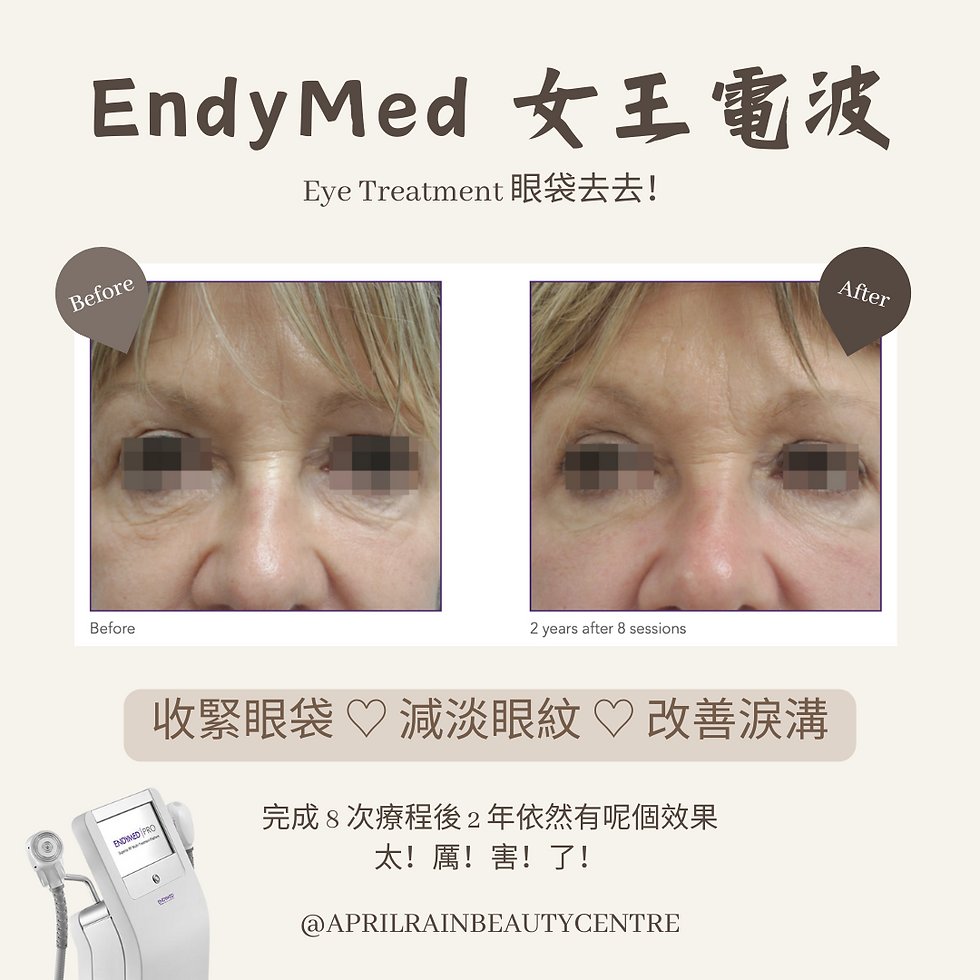 EndyMed Pro 女王電波 前後對比圖