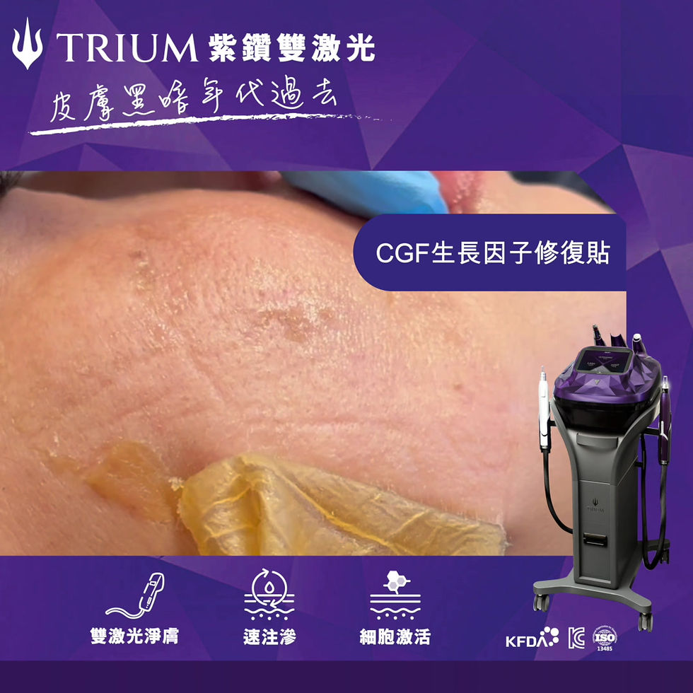 縮圖：TRIUM 紫鑽雙激光