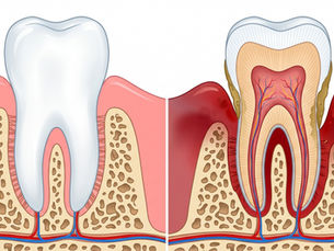 Periodontoloji (Diş Eti Hastalıkları) ile Temeli Sağlam Bir Gülüş