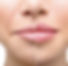 Hyloric-Lips-Treatment-Las-Vegas.jpg
