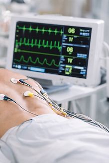 Eletrodos e monitor de ECG.png