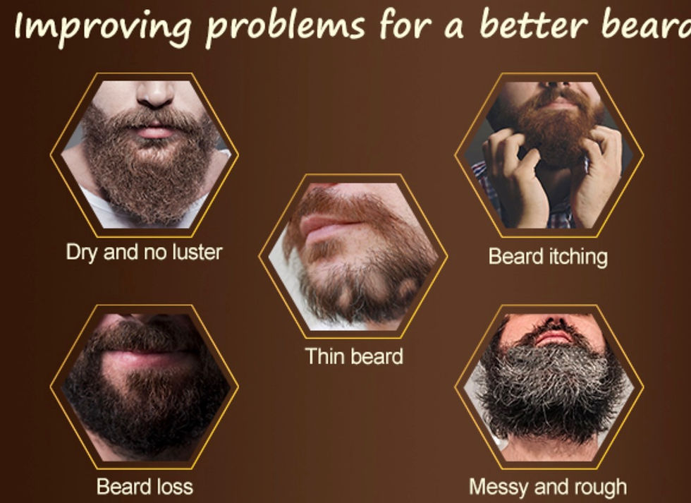 Miniatura: Beard problems: dry, no luster, itching, thin, loss, messy, row.