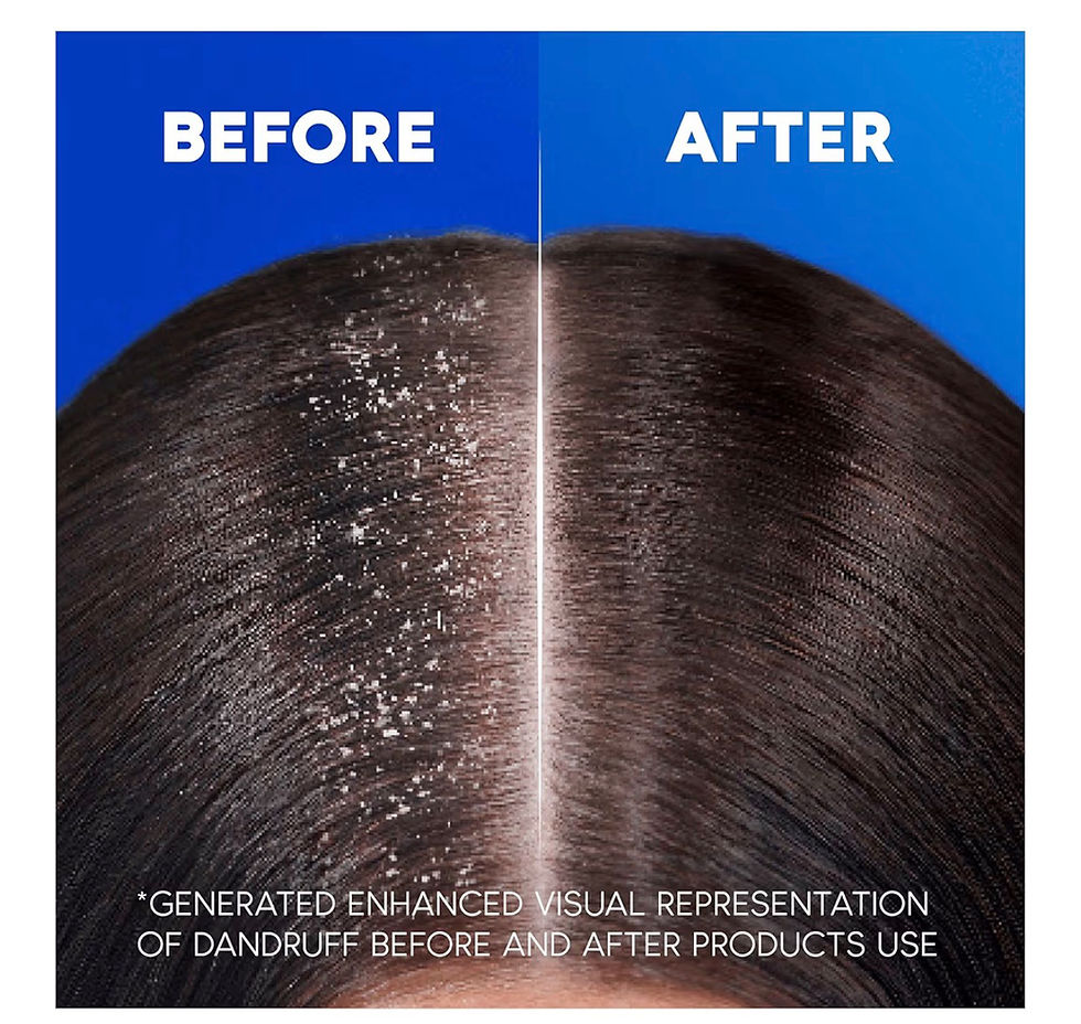 Миниатюра: Head & Shoulders Classic Clean 2in1 Anti Dandruff Shampoo, 1000ml. Up to 100% Fl