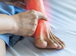 Foot Stress Fractures: What They Are, Why They Happen, and How Physiotherapy Helps You Recover Safely