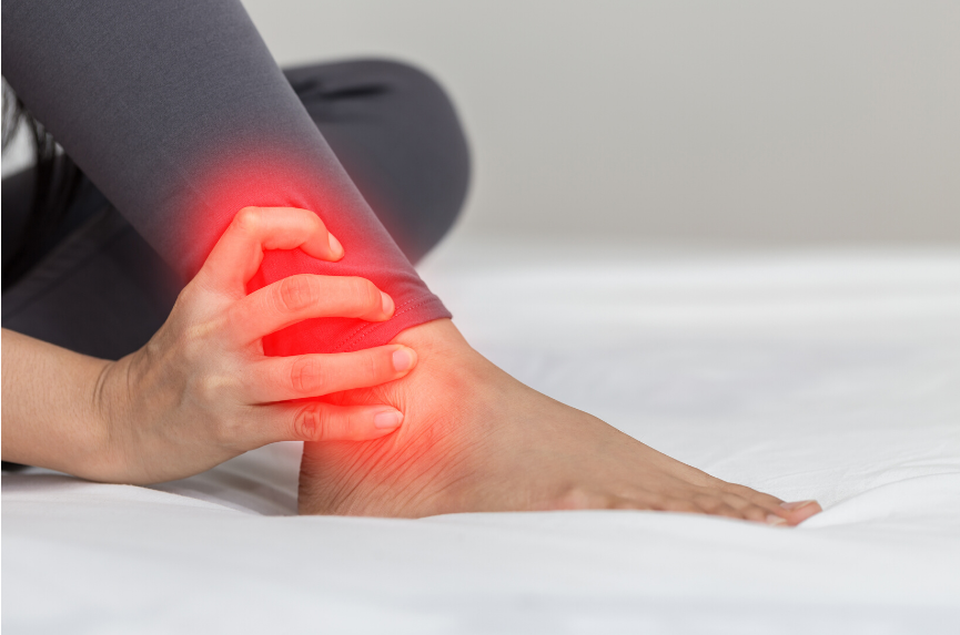 High Ankle Sprain (Syndesmosis Injury): Causes, Symptoms, and Physiotherapy Treatment