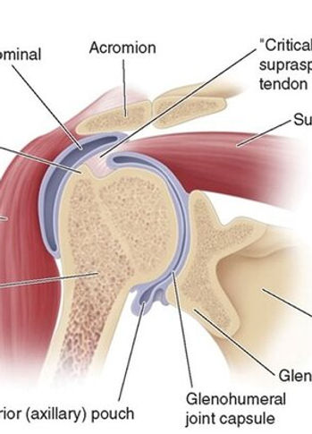 Shoulder Bursitis North Sydney Physiotherapy