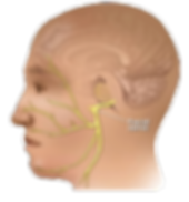 Bell's Palsy.png