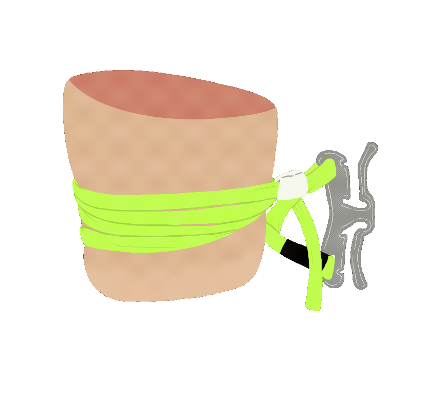 RapidTourniquet.gif
