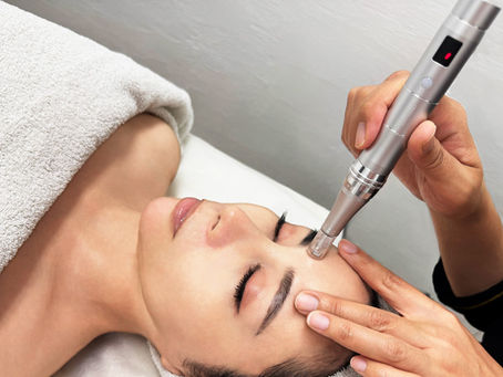 【新導入】                                             ソフトダーマで肌質改善が一気に進む