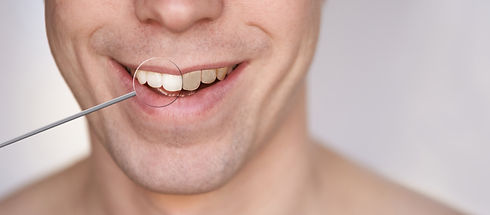 men-smile-male-smiling-person-whitening-oral-car-2022-08-01-01-50-17-utc.jpg
