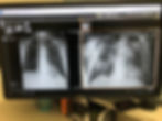 Greg Mundis X-Ray