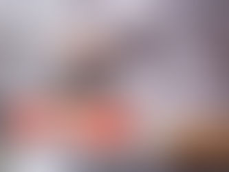 İMPLANT TEDAVİSİ SONRASI DİKKAT EDİLMESİ GEREKEN 7 KURAL