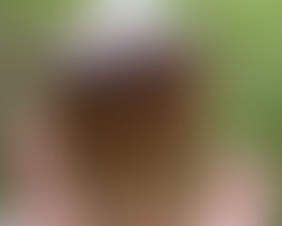 手のひらにお灸を